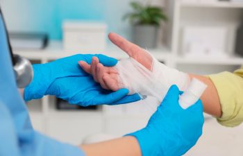 Doctor bandaging patient's burned hand in hospital, closeup