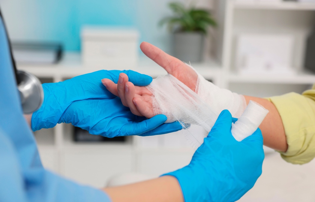 Doctor bandaging patient's burned hand in hospital, closeup