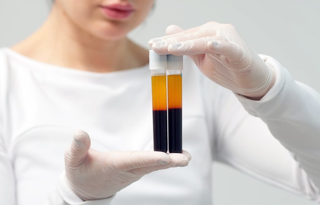 A cosmetologist in a white coat and gloves checks and demonstrates a blood collection tube with centrifuged blood - separated rich in platelets and plasma