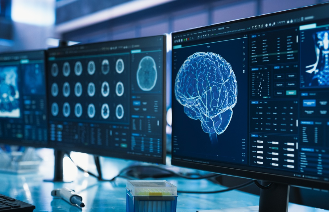 Cancer Research Center Medical Laboratory: Close Up of a Set of Desktop Computer Monitors Showing CT Scans Of Human Brain. Specialist Studying Brain Tumor, Finding Solutions, Treatment