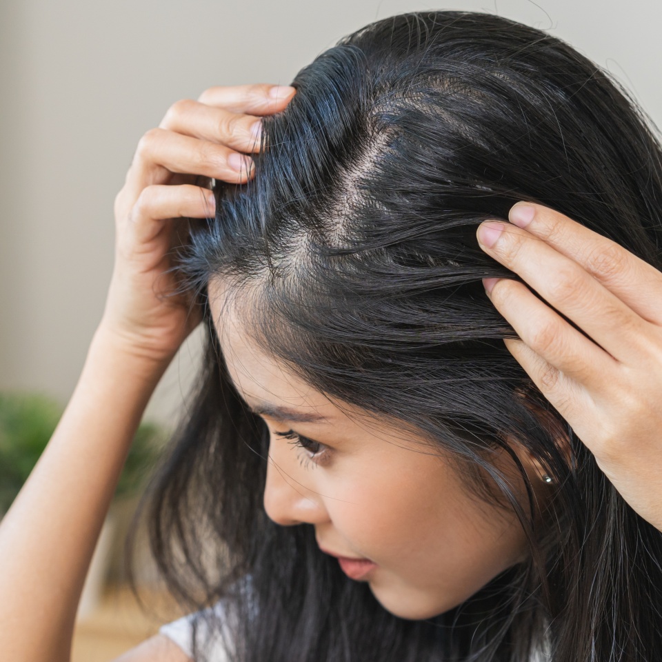 Damaged hair symptom, problem hair fall asian young woman, girl worry about balding, looking at scalp in mirror, hand in break into front hair loss, thin problem. Health care treatment for beauty.