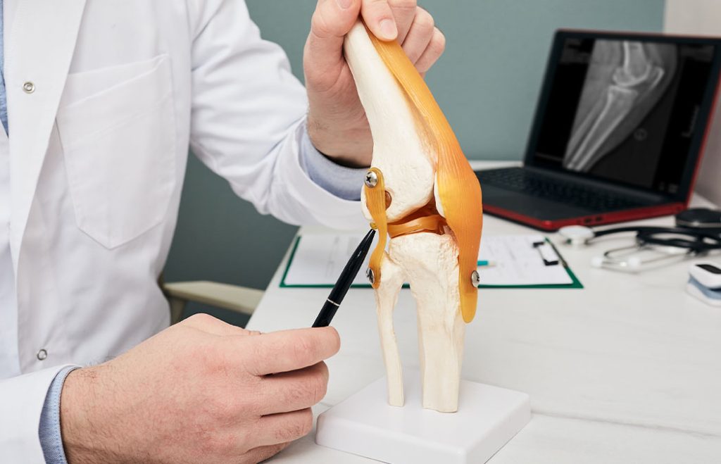 A person in a white coat points with a pen to a knee joint model, with a computer displaying an X-ray image in the background.