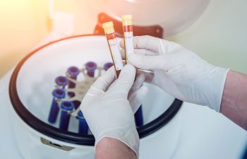 Gloved hands hold two blood sample vials in front of a centrifuge containing other test tubes.