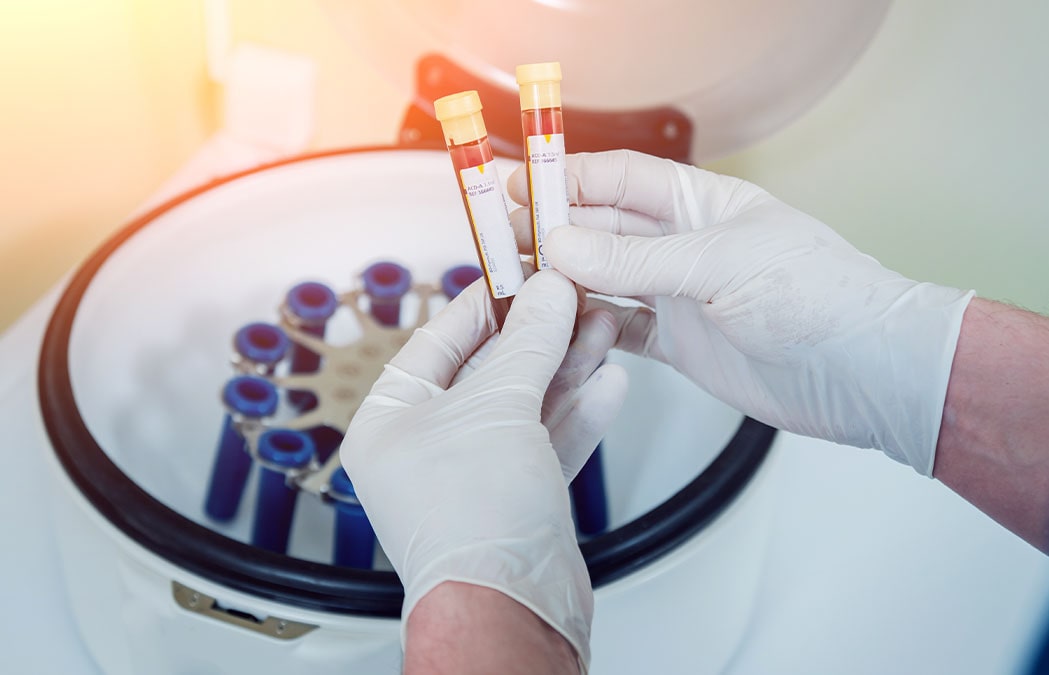 Gloved hands hold two blood sample vials in front of a centrifuge containing other test tubes.