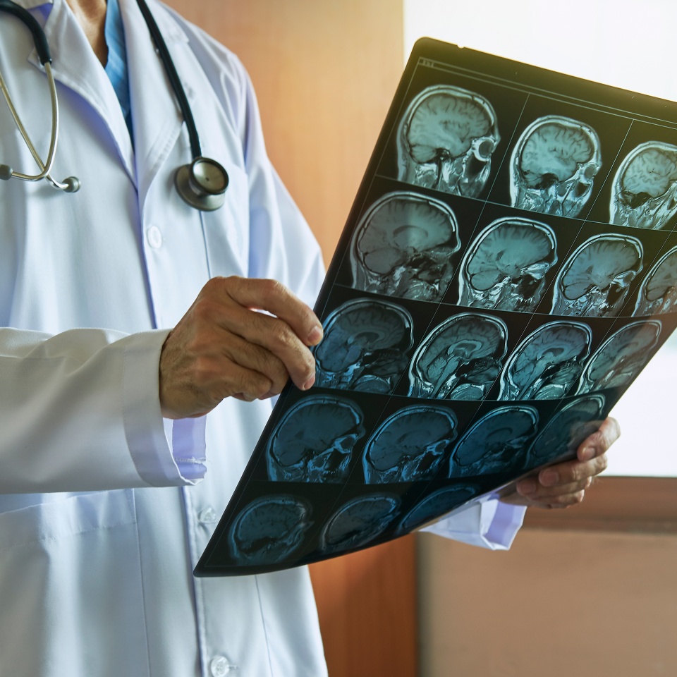 Doctor with stethoscope holding human brain MRI imaging in medical office