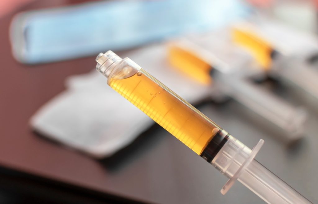 Blood plasma in a syringe on a blurred background. Blood plasma as a solution for the treatment of coronavirus. Platelet-rich plasma preparation for plasmolifting therapy. Selective focus.