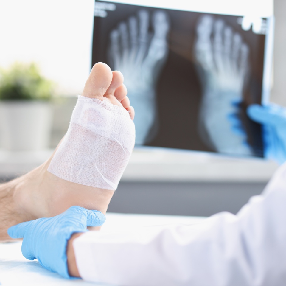 A doctor looks at an x-ray of a man's injured leg, close-up, blurry. Traumatologist, pain on the sole of the foot