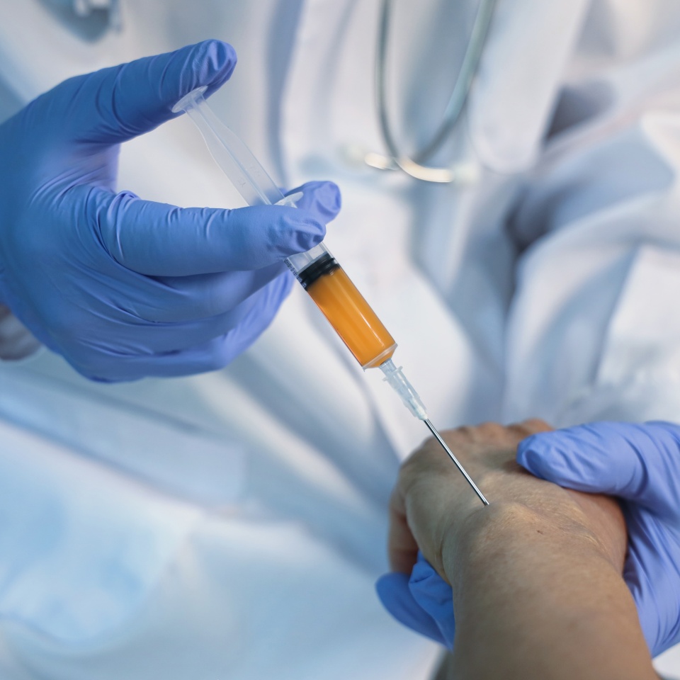 Wrist injection treatment. Platelet-rich plasma (PRP) injection