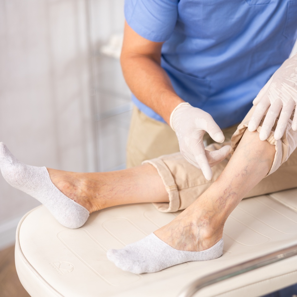 Close-up male doctor exam legs of senior woman against varicose veins, before sclerotherapy treatment. Nurse filling the document.